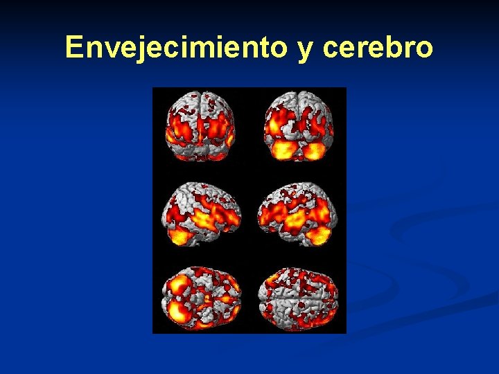 Envejecimiento y cerebro Envejecimiento y cerebro