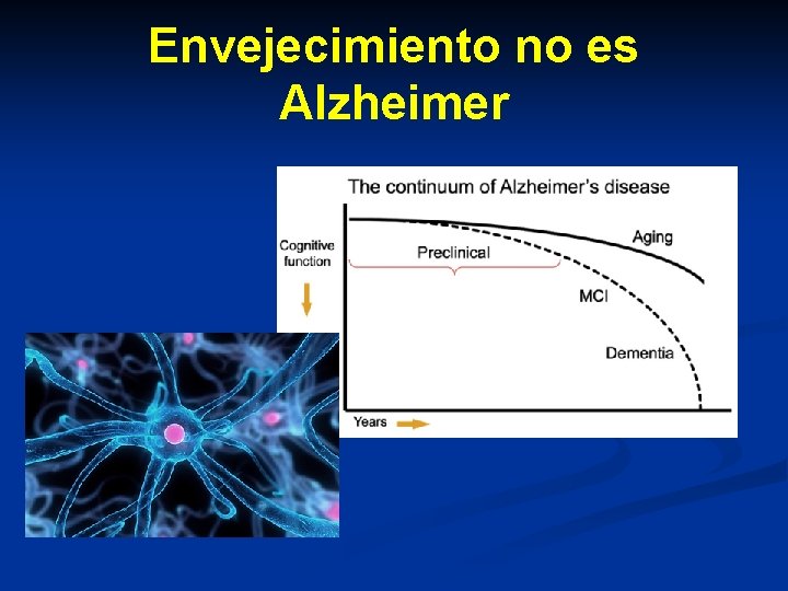 Envejecimiento no es Alzheimer Envejecimiento no es Alzheimer