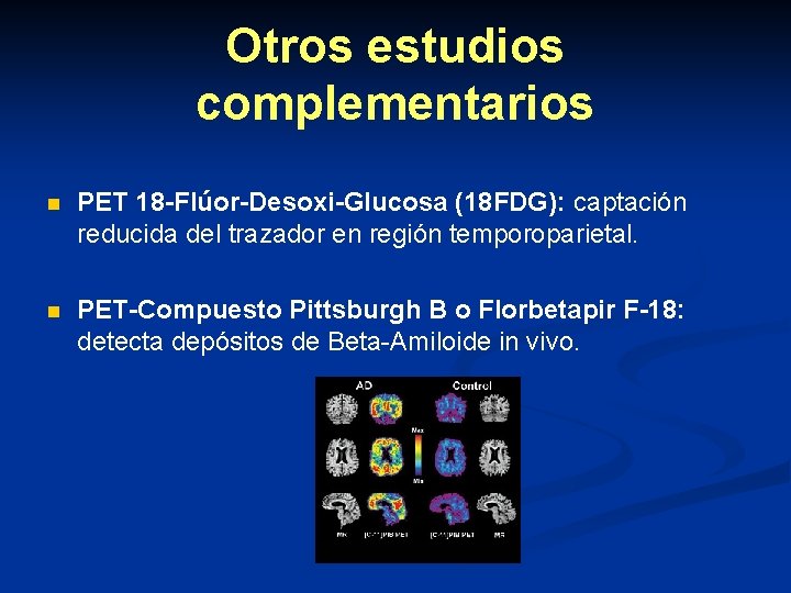 Otros estudios complementarios n PET 18 -Flúor-Desoxi-Glucosa (18 FDG): captación reducida del trazador en Otros estudios complementarios n PET 18 -Flúor-Desoxi-Glucosa (18 FDG): captación reducida del trazador en