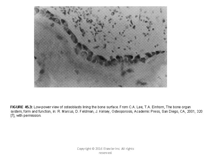 FIGURE 45. 3: Low-power view of osteoblasts lining the bone surface. From C. A.