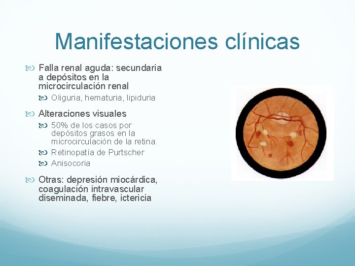 Manifestaciones clínicas Falla renal aguda: secundaria a depósitos en la microcirculación renal Oliguria, hematuria,