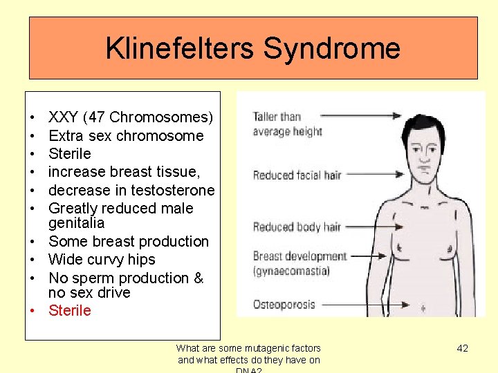 Klinefelters Syndrome • • • XXY (47 Chromosomes) Extra sex chromosome Sterile increase breast