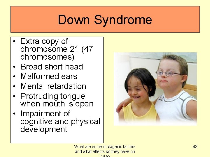 Down Syndrome • Extra copy of chromosome 21 (47 chromosomes) • Broad short head
