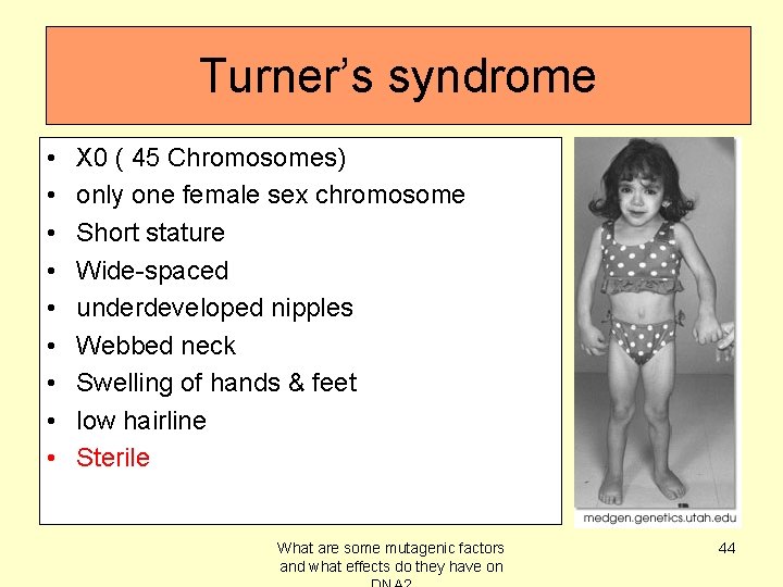 Turner’s syndrome • • • X 0 ( 45 Chromosomes) only one female sex