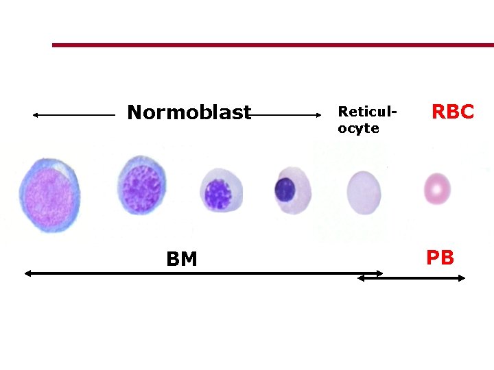 Normoblast BM Reticulocyte RBC PB 