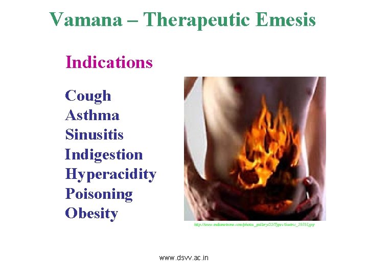 Vamana – Therapeutic Emesis Indications Cough Asthma Sinusitis Indigestion Hyperacidity Poisoning Obesity http: //www.