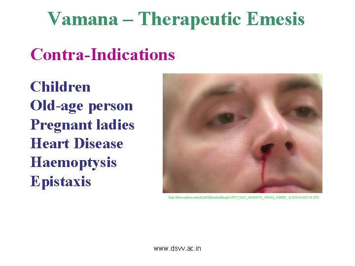 Vamana – Therapeutic Emesis Contra-Indications Children Old-age person Pregnant ladies Heart Disease Haemoptysis Epistaxis