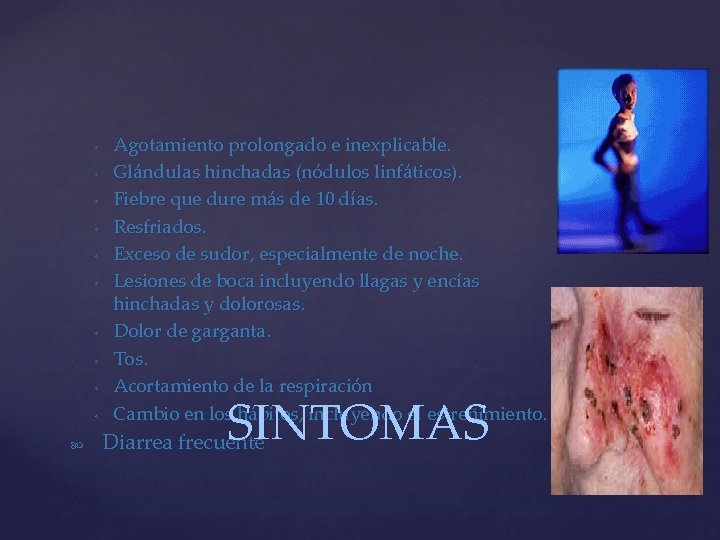 ◦ ◦ ◦ ◦ ◦ Agotamiento prolongado e inexplicable. Glándulas hinchadas (nódulos linfáticos). Fiebre