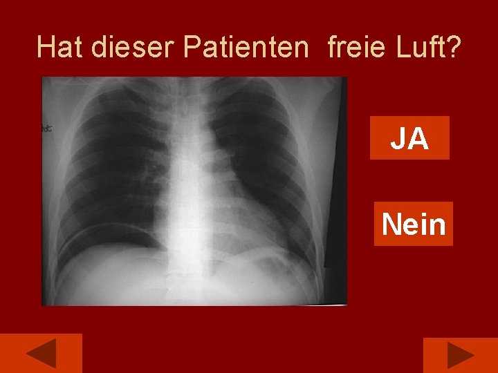 Hat dieser Patienten freie Luft? JA Nein 