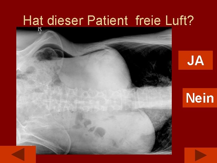 Hat dieser Patient freie Luft? JA Nein 