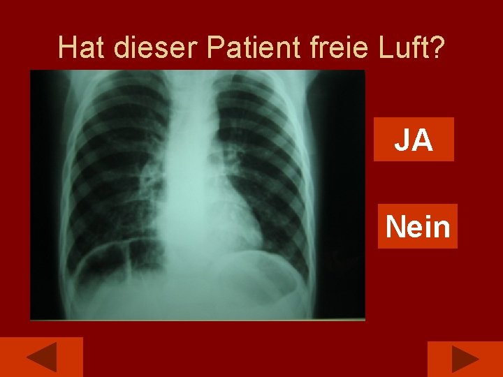 Hat dieser Patient freie Luft? JA Nein 