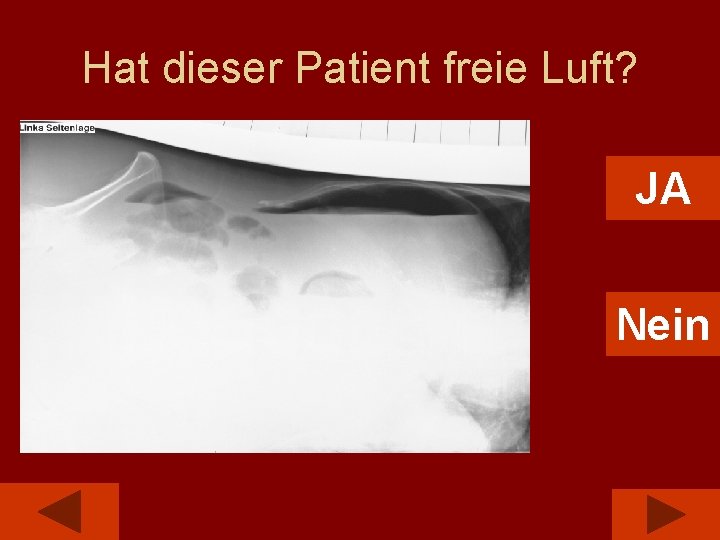 Hat dieser Patient freie Luft? JA Nein 