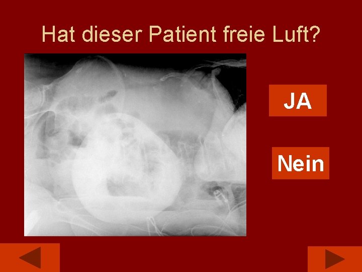 Hat dieser Patient freie Luft? JA Nein 