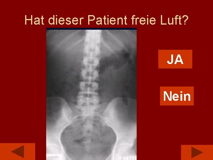 Hat dieser Patient freie Luft? JA Nein 