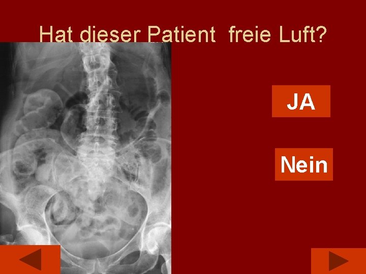 Hat dieser Patient freie Luft? JA Nein 