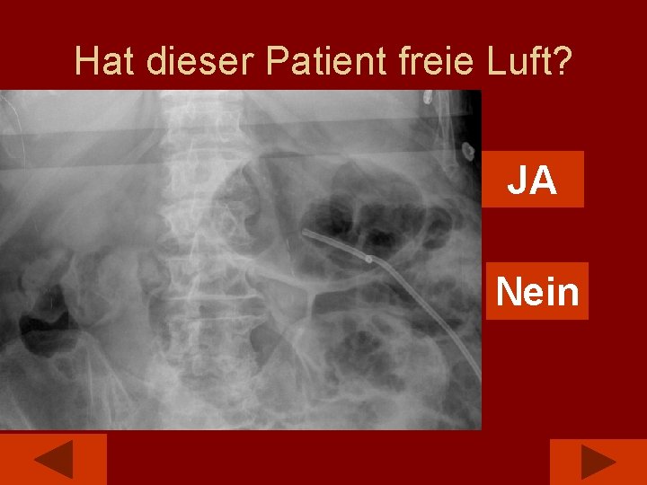 Hat dieser Patient freie Luft? JA Nein 