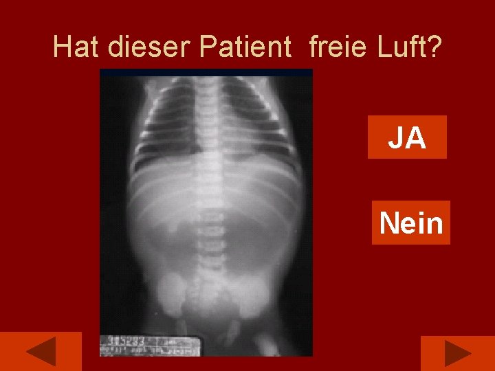 Hat dieser Patient freie Luft? JA Nein 