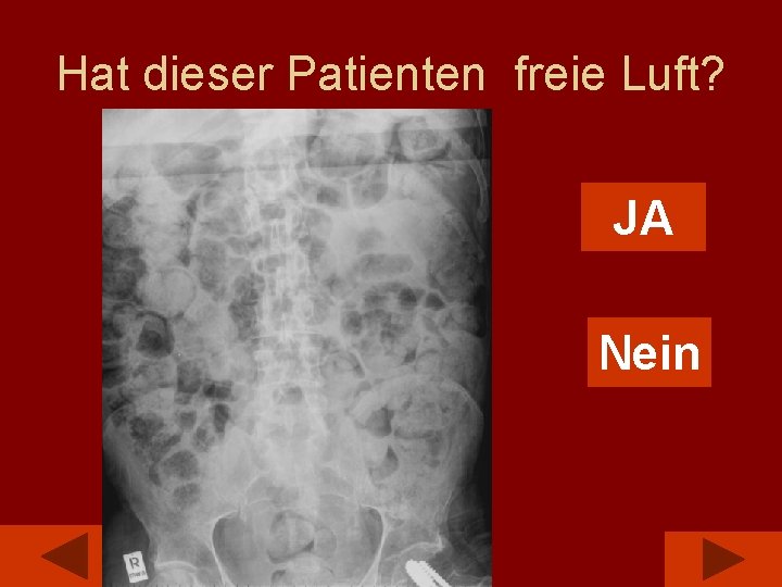 Hat dieser Patienten freie Luft? JA Nein 
