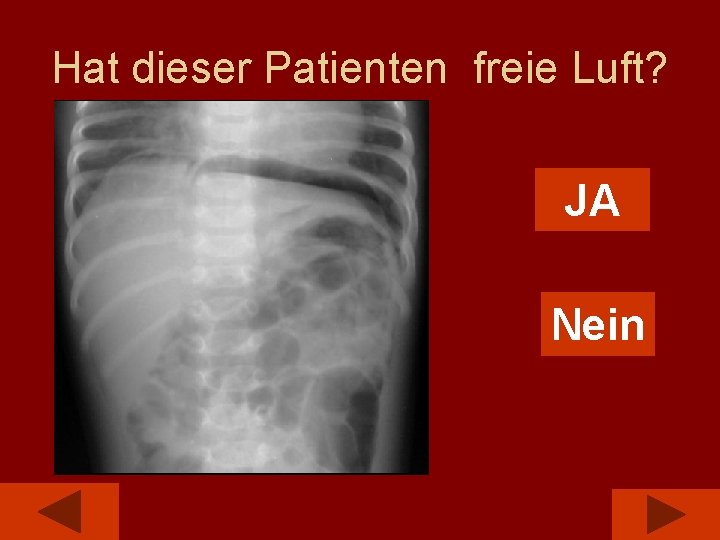 Hat dieser Patienten freie Luft? JA Nein 