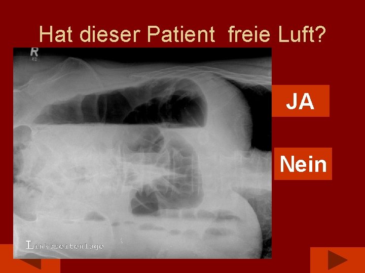 Hat dieser Patient freie Luft? JA Nein 