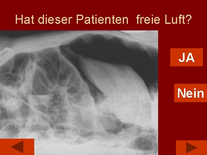 Hat dieser Patienten freie Luft? JA Nein 