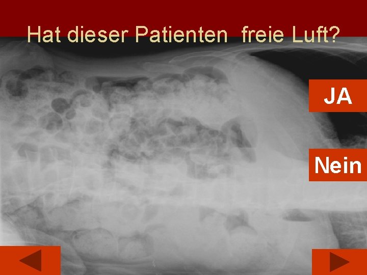 Hat dieser Patienten freie Luft? JA Nein 