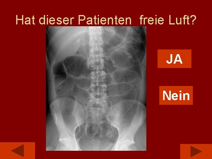 Hat dieser Patienten freie Luft? JA Nein 
