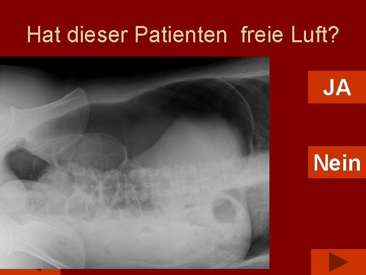 Hat dieser Patienten freie Luft? JA Nein 