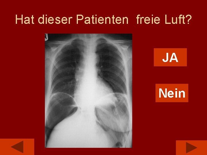 Hat dieser Patienten freie Luft? JA Nein 