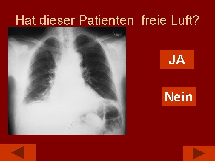 Hat dieser Patienten freie Luft? JA Nein 