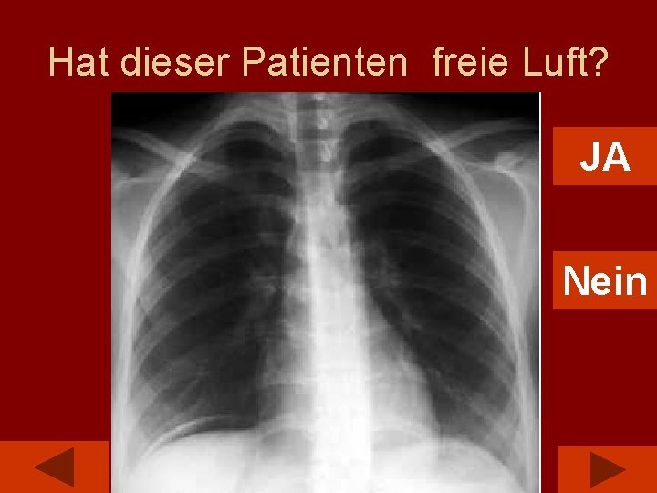 Hat dieser Patienten freie Luft? JA Nein 
