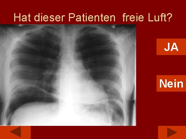 Hat dieser Patienten freie Luft? JA Nein 