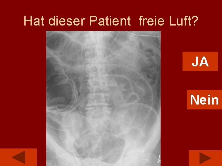 Hat dieser Patient freie Luft? JA Nein 