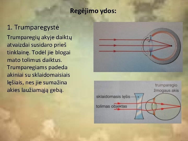 Regėjimo ydos: 1. Trumparegystė Trumparegių akyje daiktų atvaizdai susidaro prieš tinklainę. Todėl jie blogai