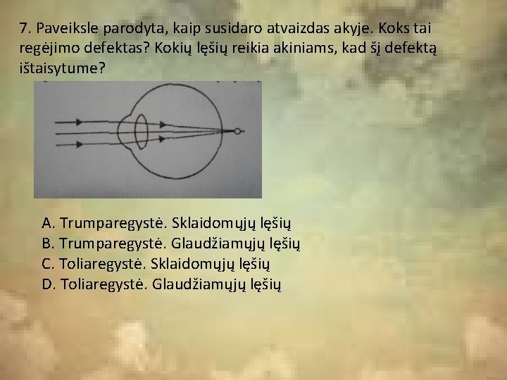 7. Paveiksle parodyta, kaip susidaro atvaizdas akyje. Koks tai regėjimo defektas? Kokių lęšių reikia 7. Paveiksle parodyta, kaip susidaro atvaizdas akyje. Koks tai regėjimo defektas? Kokių lęšių reikia