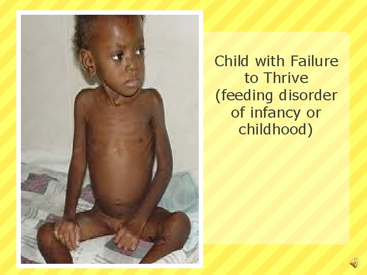 Child with Failure to Thrive (feeding disorder of infancy or childhood) 