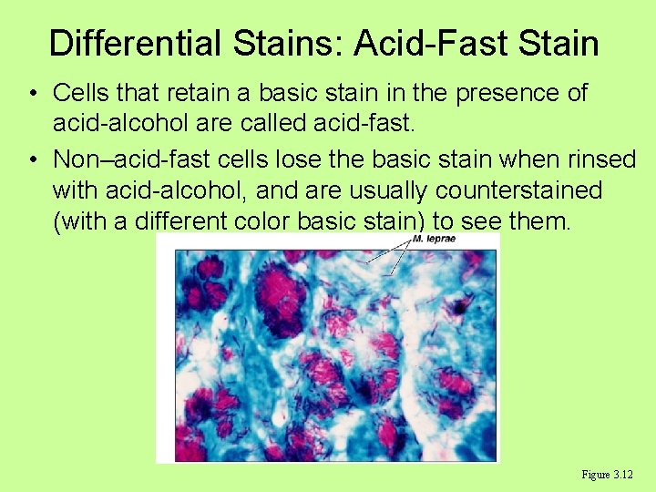 Differential Stains: Acid-Fast Stain • Cells that retain a basic stain in the presence