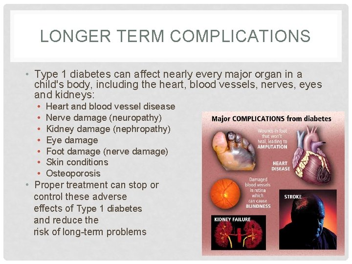 LONGER TERM COMPLICATIONS • Type 1 diabetes can affect nearly every major organ in