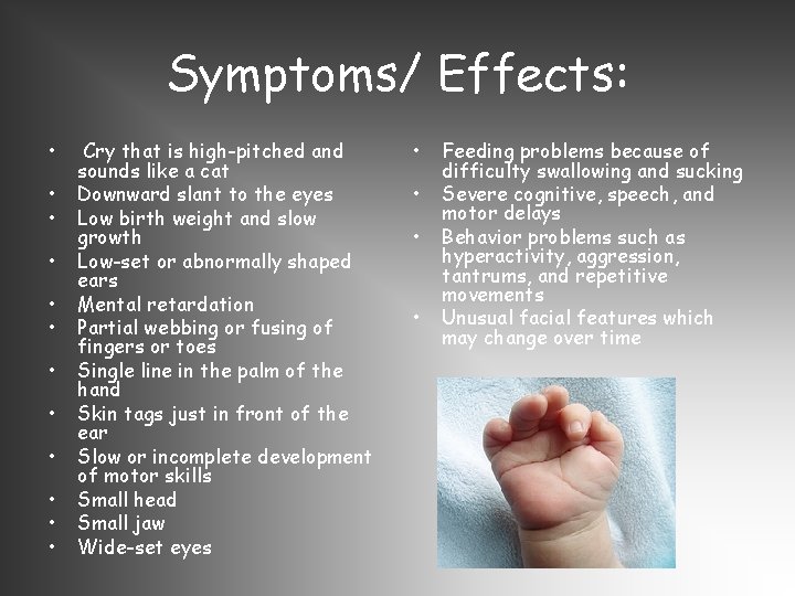 Symptoms/ Effects: • • • Cry that is high-pitched and sounds like a cat