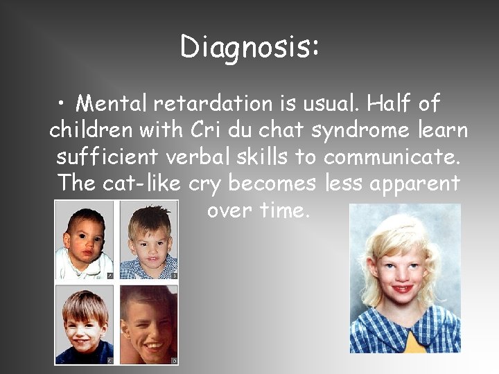 Diagnosis: • Mental retardation is usual. Half of children with Cri du chat syndrome