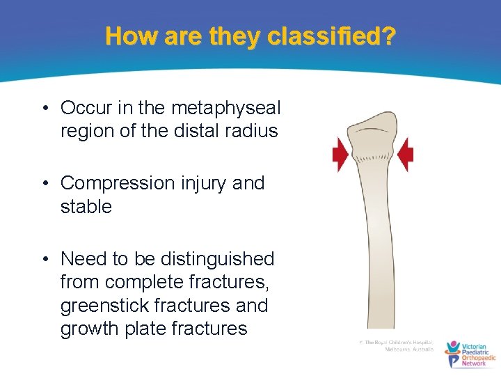 How are they classified? • Occur in the metaphyseal region of the distal radius