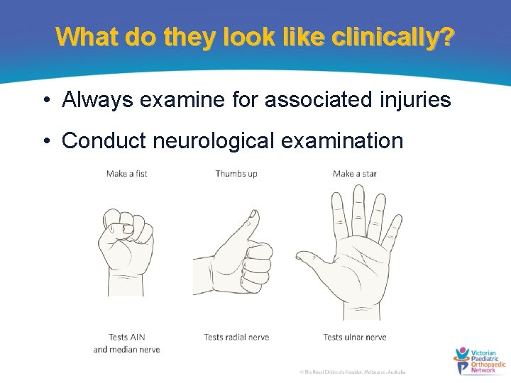 What do they look like clinically? • Always examine for associated injuries • Conduct