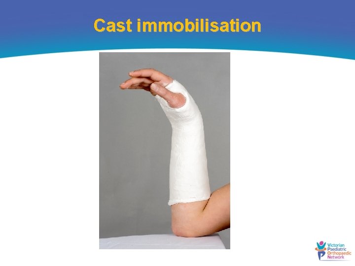 Cast immobilisation 