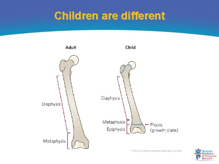 Children are different 