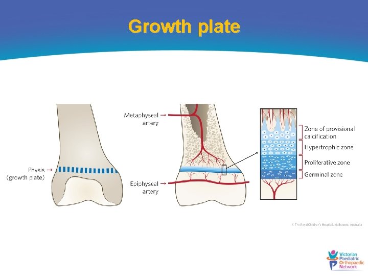 Growth plate 