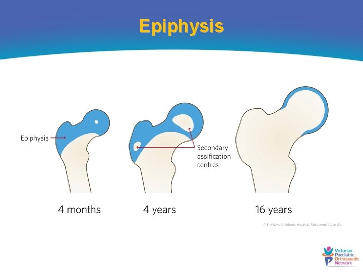 Epiphysis 