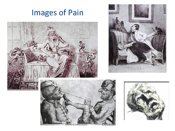 Images of Pain 