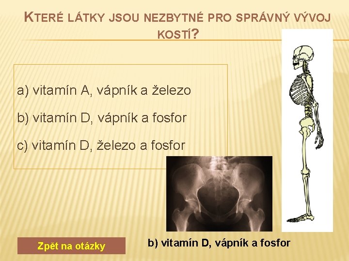  KTERÉ LÁTKY JSOU NEZBYTNÉ PRO SPRÁVNÝ VÝVOJ KOSTÍ? a) vitamín A, vápník a