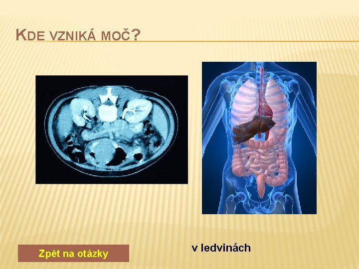 KDE VZNIKÁ MOČ? Zpět na otázky v ledvinách 