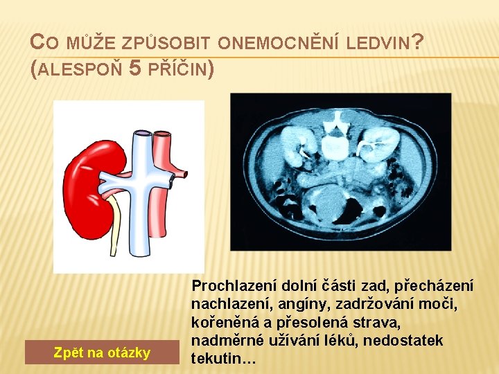 CO MŮŽE ZPŮSOBIT ONEMOCNĚNÍ LEDVIN? (ALESPOŇ 5 PŘÍČIN) Zpět na otázky Prochlazení dolní části